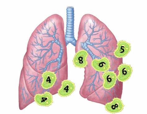 drugresistantbacteria
